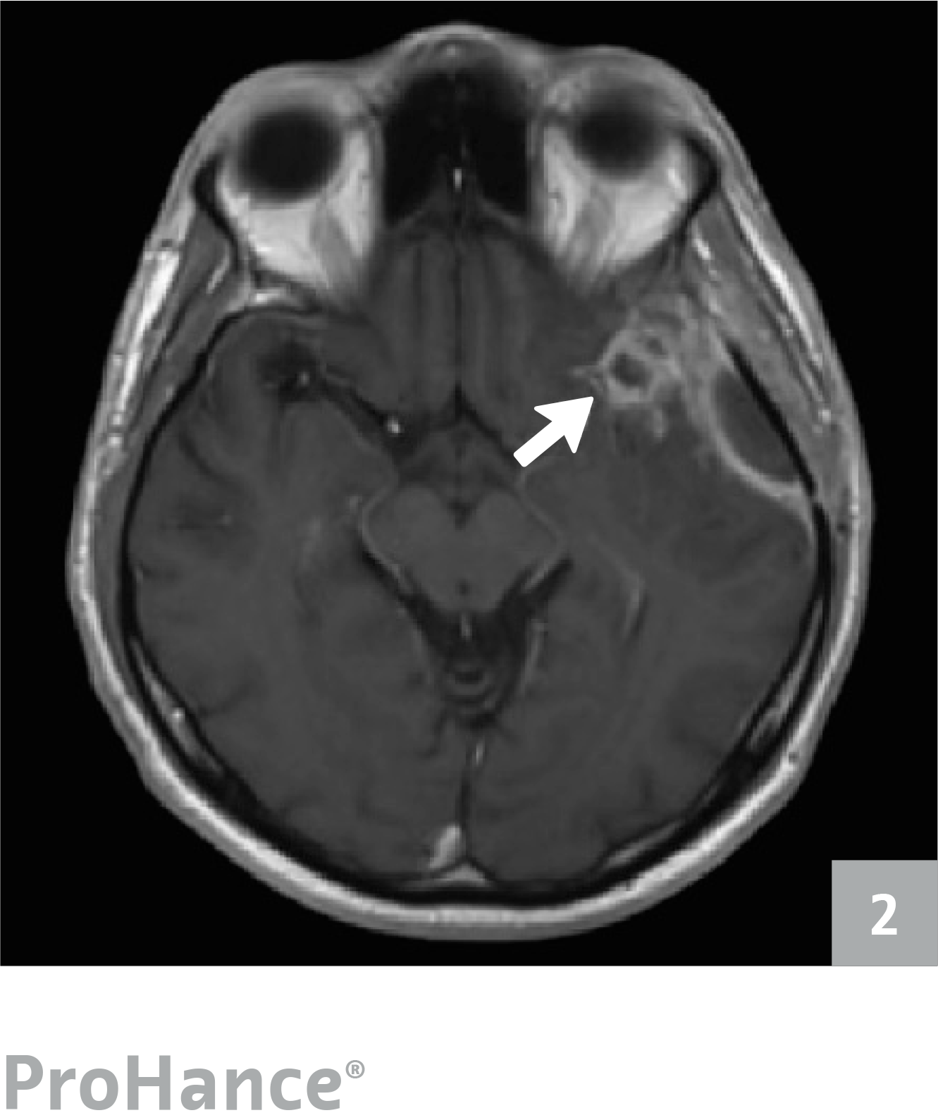 Prohance Scan