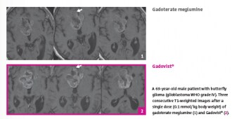 RI015 [EN] Better visualization and lesion enhancement