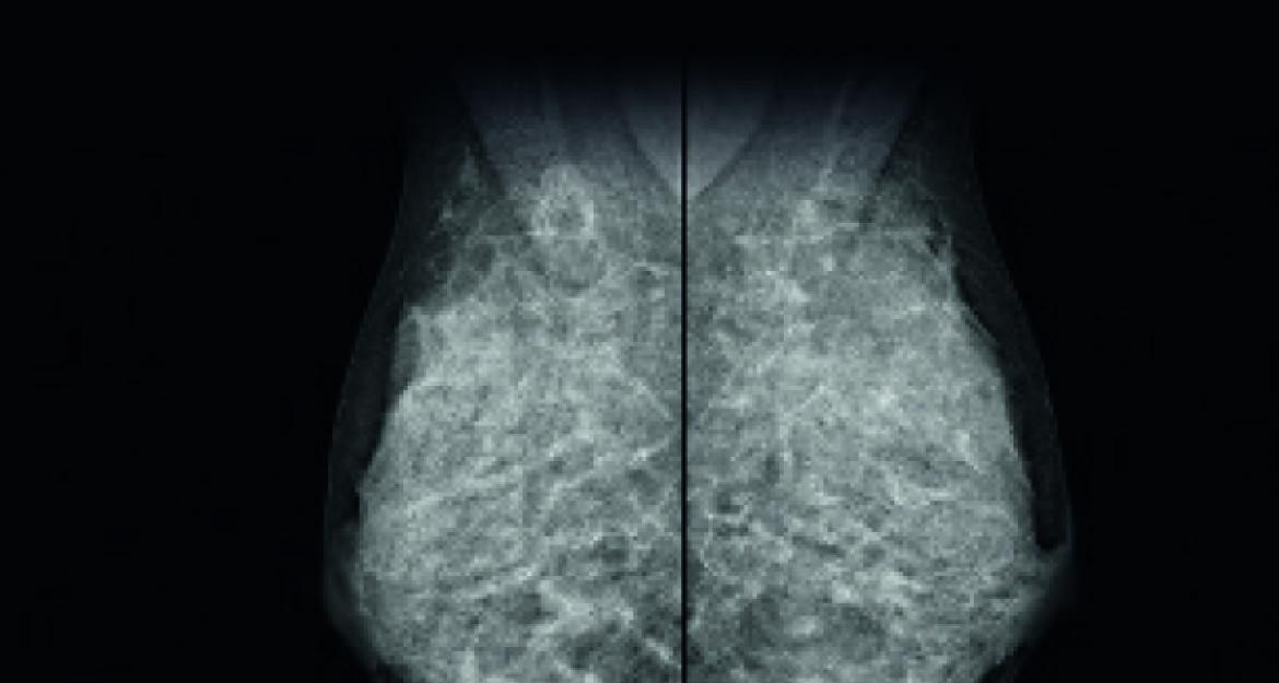 breast