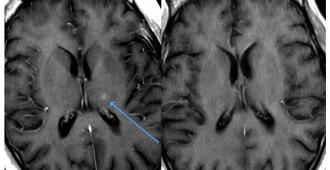 ri017_en_lower_relaxivity_mr_contrast_agent_v3_.jpg