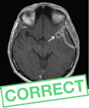 Gadovist<sup>®</sup>-enhanced brain question 1