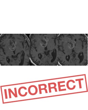Dotarem<sup>®</sup>-enhanced brain question 2