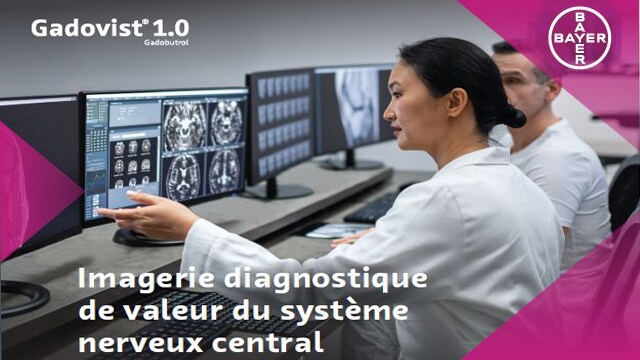 Multiple Sclerosis