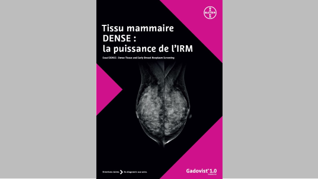 MRI in Dense Breasts