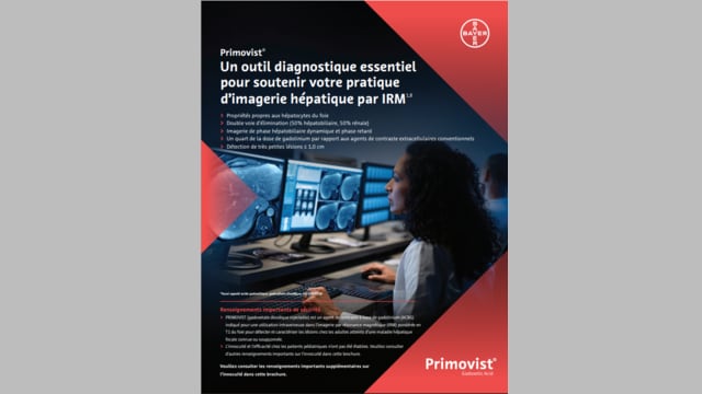 What makes primovist unique