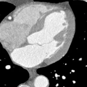 033_Tab1-Image3_DualFlow